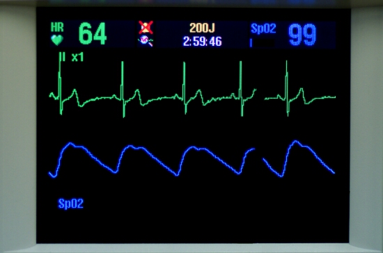 Monitoring B3C47A8E-58A2-11E1-9B5F-199C65B94067
